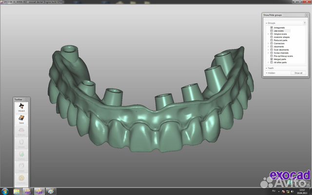 Зубной техник CAD/CAM